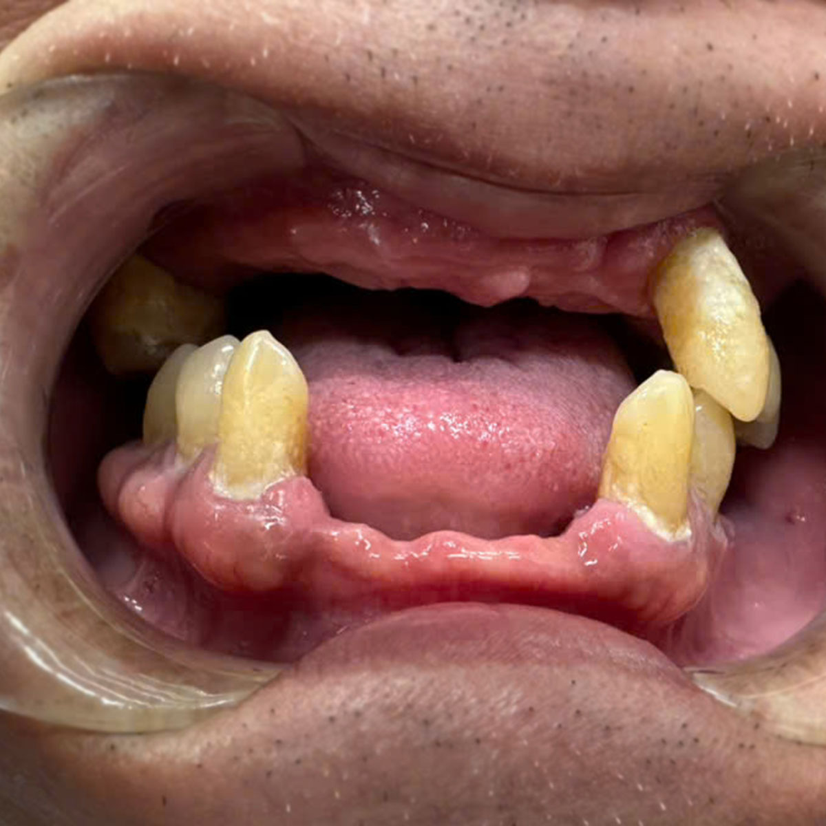 Phim X-Quang Chú Tuyền