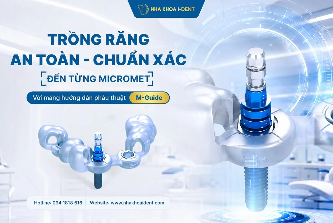 Bác sĩ Nha khoa I-Dent hội chẩn phim chụp CT Cone Beam 3D trước khi cấy Implant toàn hàm All-on-4 và All-on-6